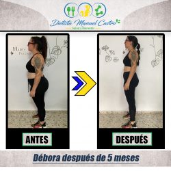 debeoraantesdespuesperfil